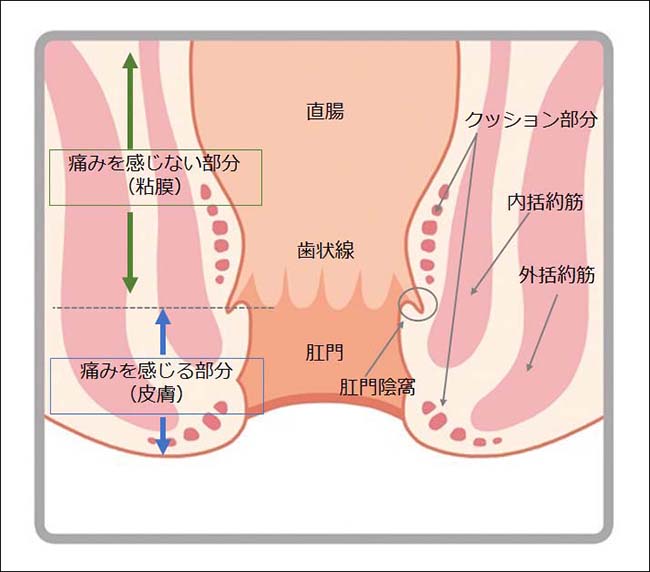 いぼ痔